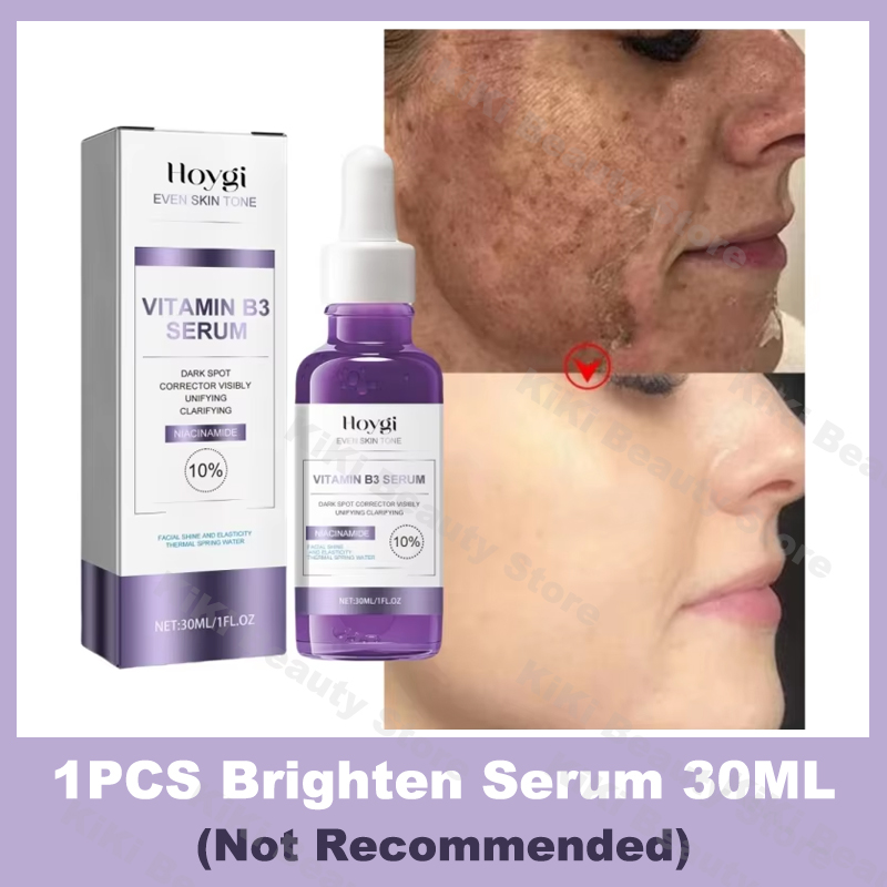 Powerful Dark Spots Remover Whitening Serum Face Freckle Melanin Correcting Anti Pigmentation Brighten Skin Beauty Care Products