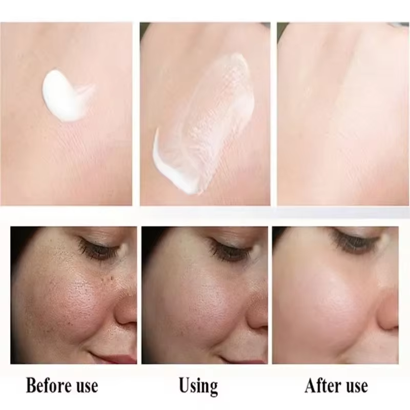 Effective Whitening Freckles Face Cream Dark Spot Corrector Remove Melasma Fade Melanin Pigmentation Brighten Skin Care Products
