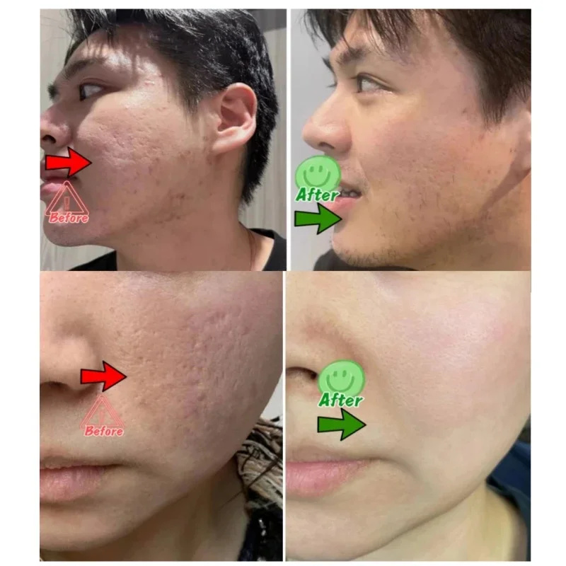 Pore Shrinking Cream Elimination Large Pores Blackehead Remove Acne Pit Repair Gel Tighten Face Smooth Skin Korean Care Products