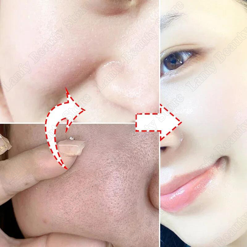 Salicylic Acid Pore Clearing Cream Shrink Pores Remove Blackheads Acne Brighten Moisturizing Smooth Skin Care Korean Products