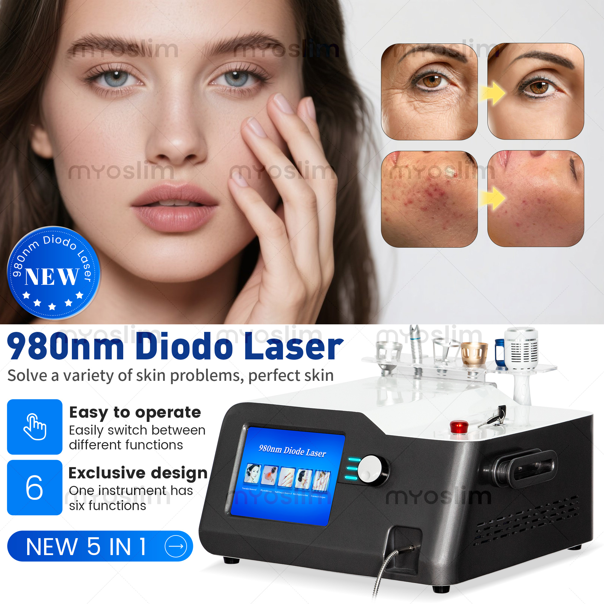 BEST 5 in 1 980nm Diode Laser Vascular Removal Machine Remove Spider Veins 980 Diode Laser Blood Vessels Removal Nail Fungus