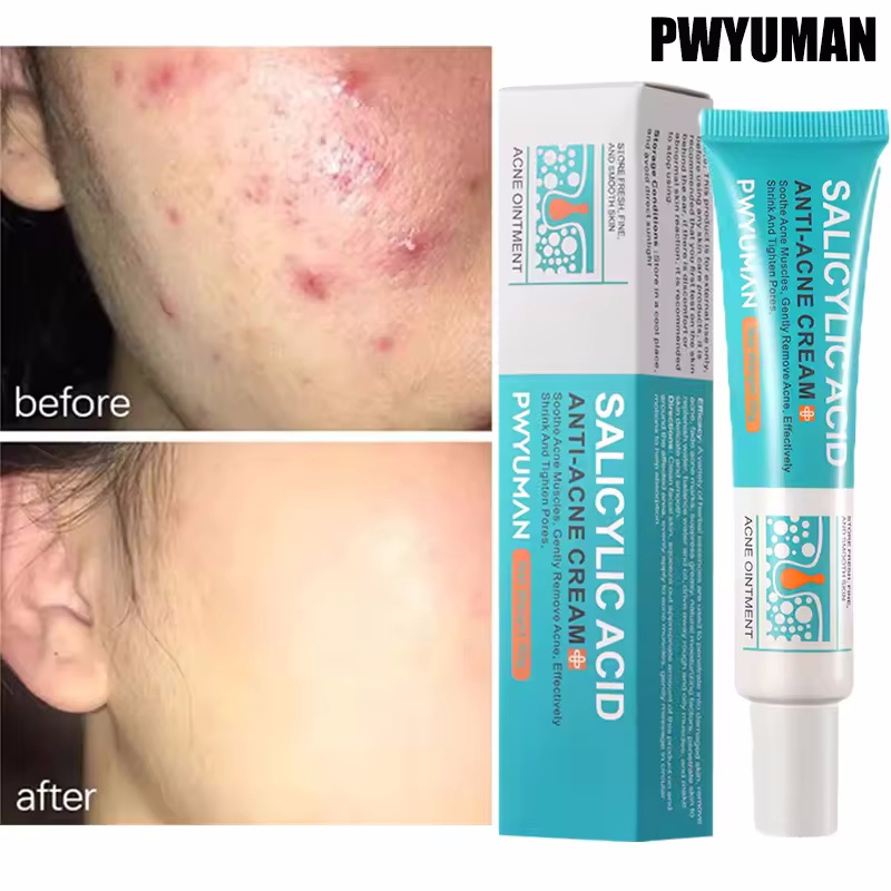 Pore Shrinking Cream Elimination Large Pores Blackehead Remove Acne Pit Repair Gel Tighten Face Smooth Skin Korean Care Products