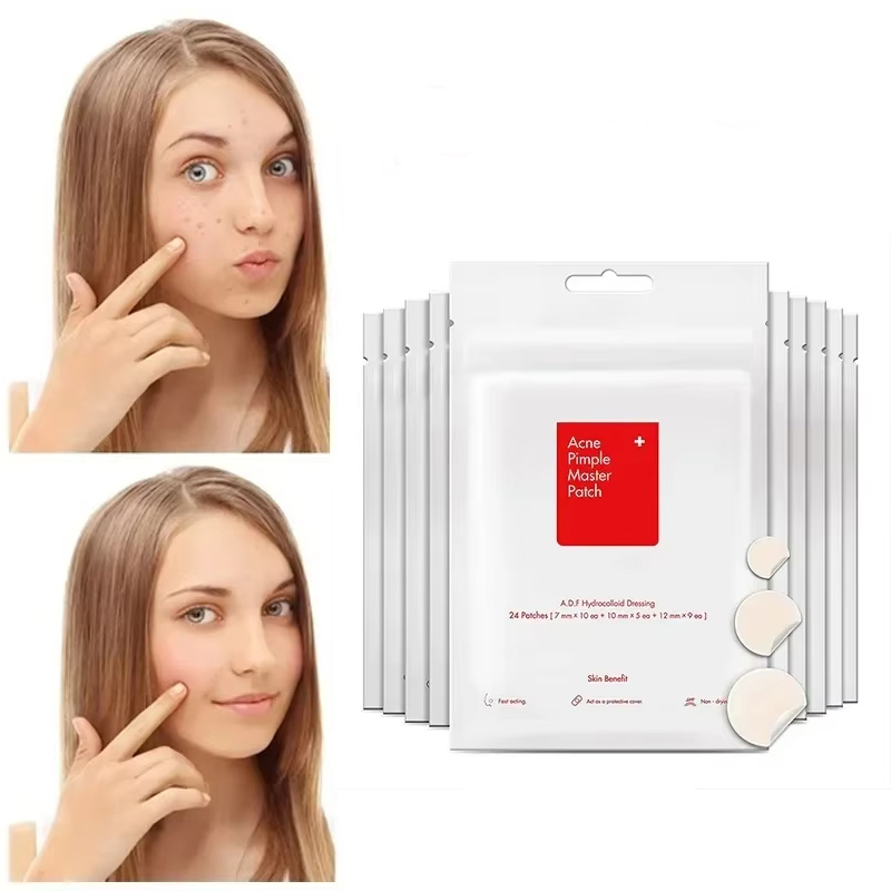 24pcs Face Acne Pimple Spot Facial Skin Care Blackhead Removal Freckle Patches Scar Care Treatment Stickers Acne Mask Beauty