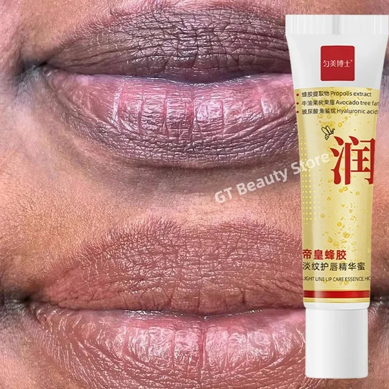 Remove Dark Lip Balm Fast Lightening Pink Lip Exfoliating Fade Lip Line Dead Skin Moisturizer Korean Care Products Beauty Health