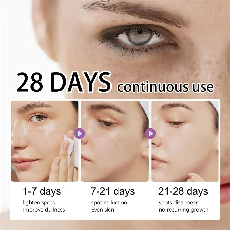 Powerful Dark Spots Remover Whitening Serum Face Freckle Melanin Correcting Anti Pigmentation Brighten Skin Beauty Care Products