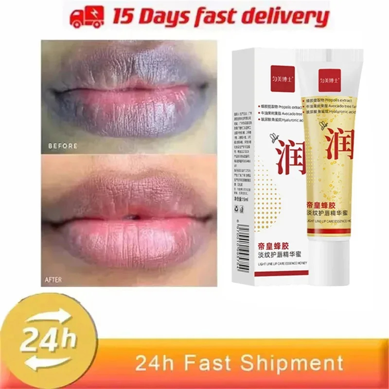 Remove Dark Lip Balm Fast Lightening Pink Lip Exfoliating Fade Lip Line Dead Skin Moisturizer Korean Care Products Beauty Health