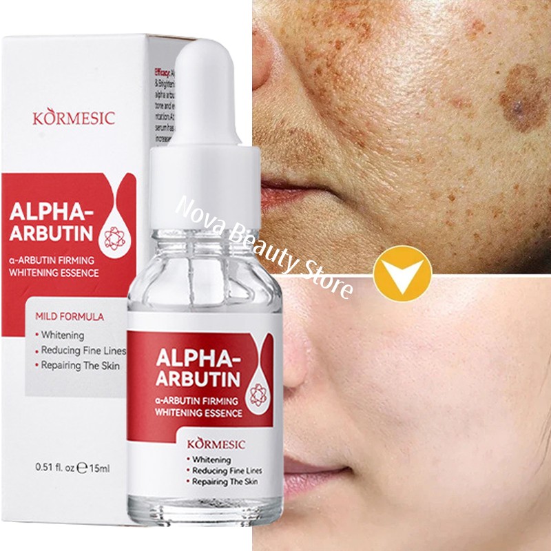 Dark Spots Remover Whitening Serum Face Freckle Melanin Correcting Reduce Fine Lines Brighten Essence Korean Beauty Skin Care