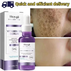 Powerful Dark Spots Remover Whitening Serum Face Freckle Melanin Correcting Anti Pigmentation Brighten Skin Beauty Care Products