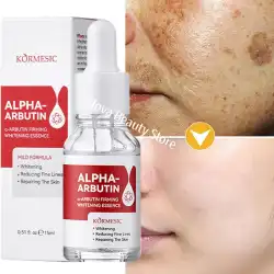 Dark Spots Remover Whitening Serum Face Freckle Melanin Correcting Reduce Fine Lines Brighten Essence Korean Beauty Skin Care