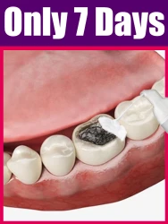 Mousse solves various problems Intraoral care tools